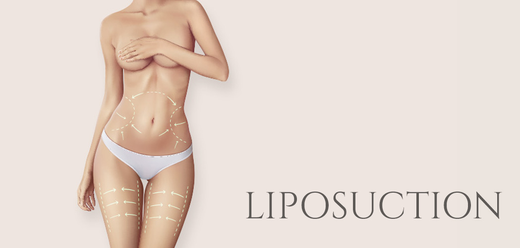 LIPOSUCTION